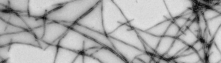 Mature Alpha-Synuclein Filaments