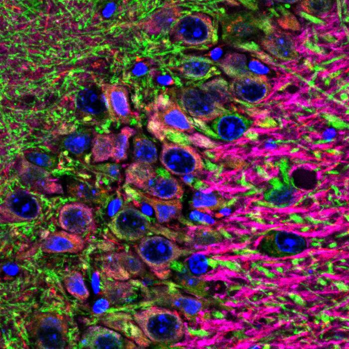 The two proteins involved in Alzheimer’s disease affect brain circuits differently