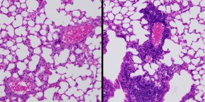 Researchers Identify Components that Keep Immune System in Check