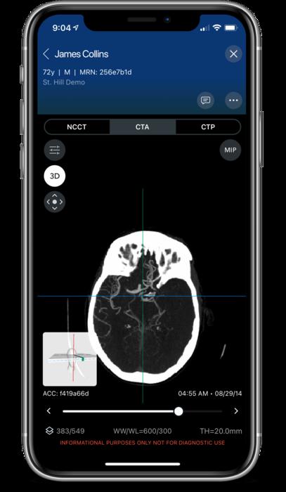 Viz.ai software