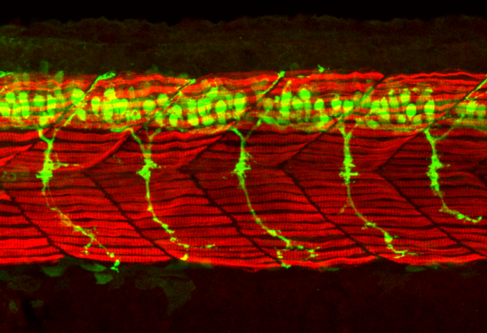 Nerve cells in a zebra fish