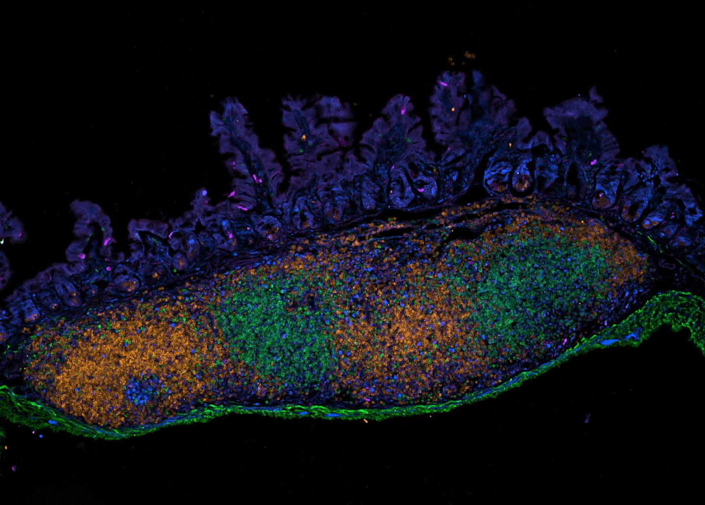 Immune Cells in the Intestine of a Young Mouse