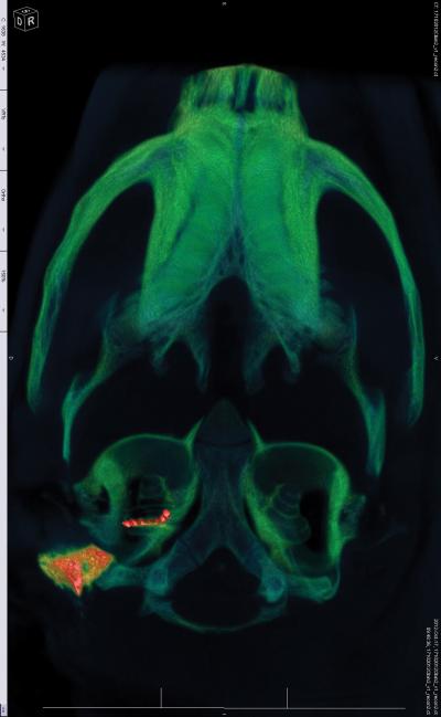 Cochlear Implant Gets an Upgrade with Gene Therapy (5 of 10)