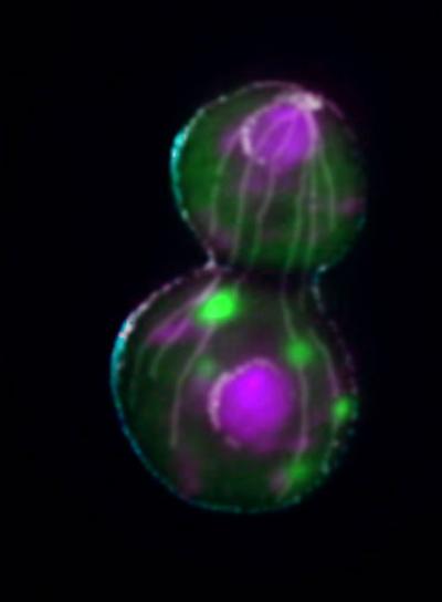 A Key Piece in the Aging Puzzle