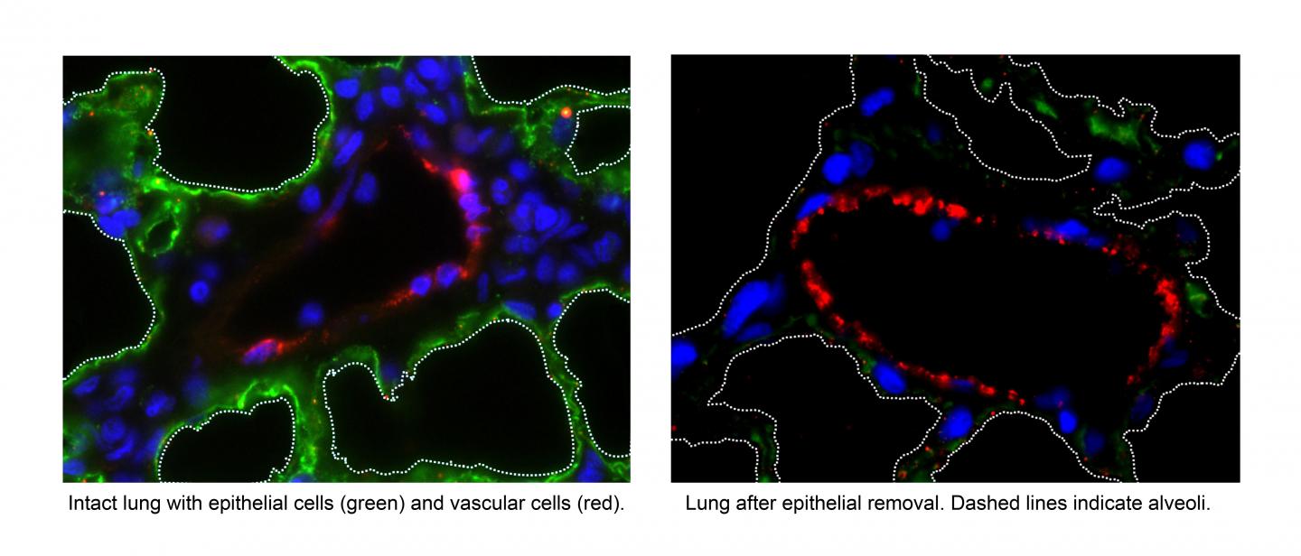 A New Approach Sets Lung Grafts Up for Success (1 of 6)