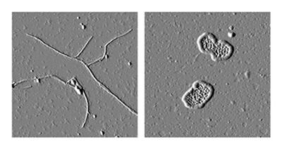 Toxic Myocilin Aggregates