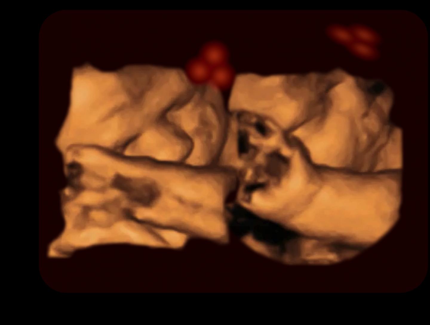 Fetus Tracking Stimulus