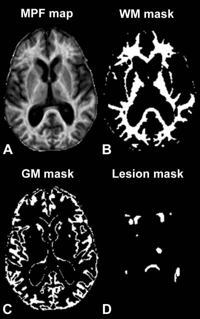 Example Axial Sections
