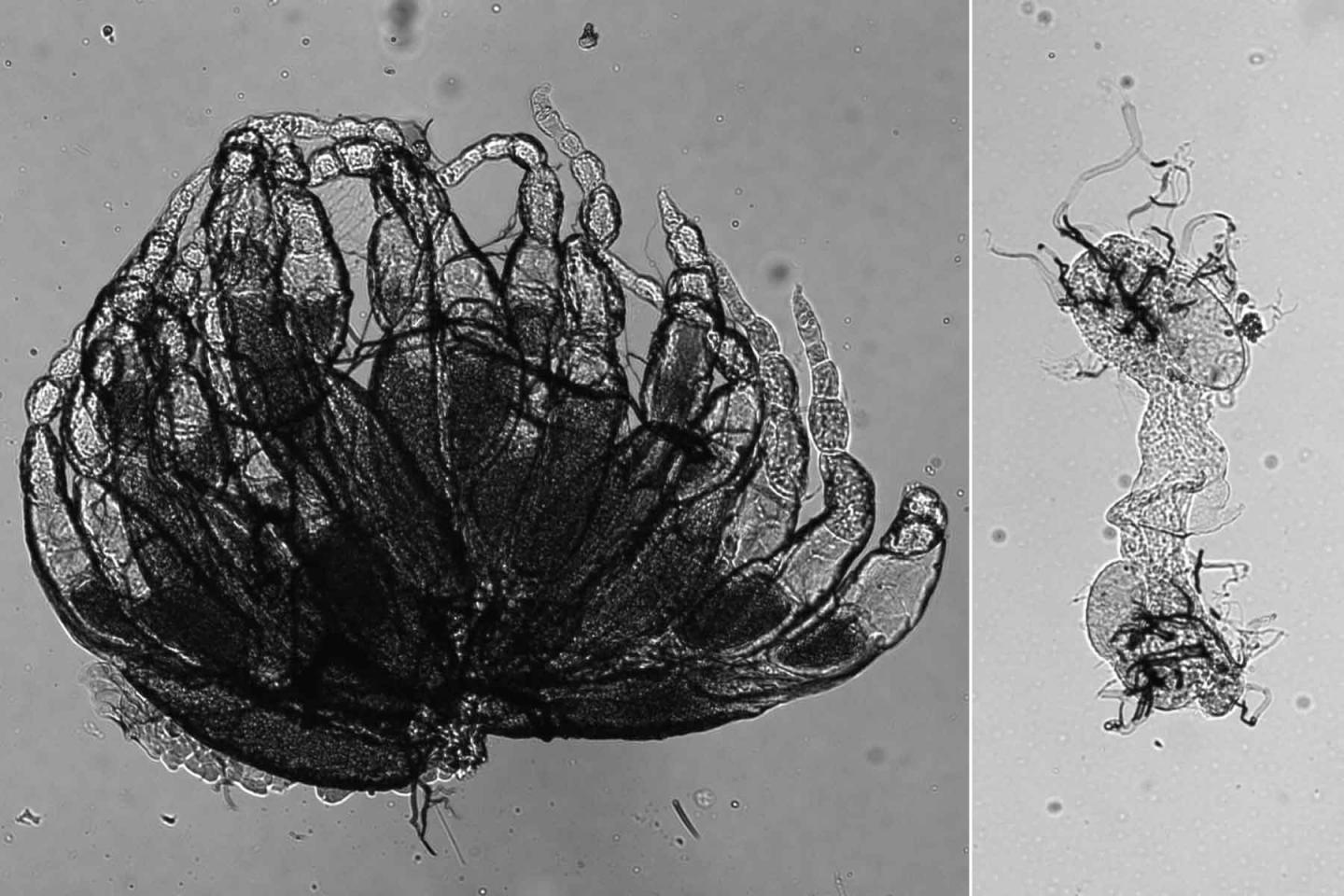 Genetic Mutations May Be Linked to Infertility, Early Menopause