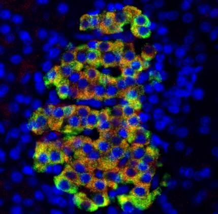 Insulin-Producing Cells Express a Bacteria-Killing Protein