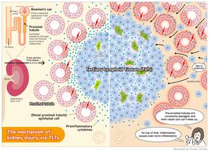 Cell interactions in abnormal structures in aged kidneys