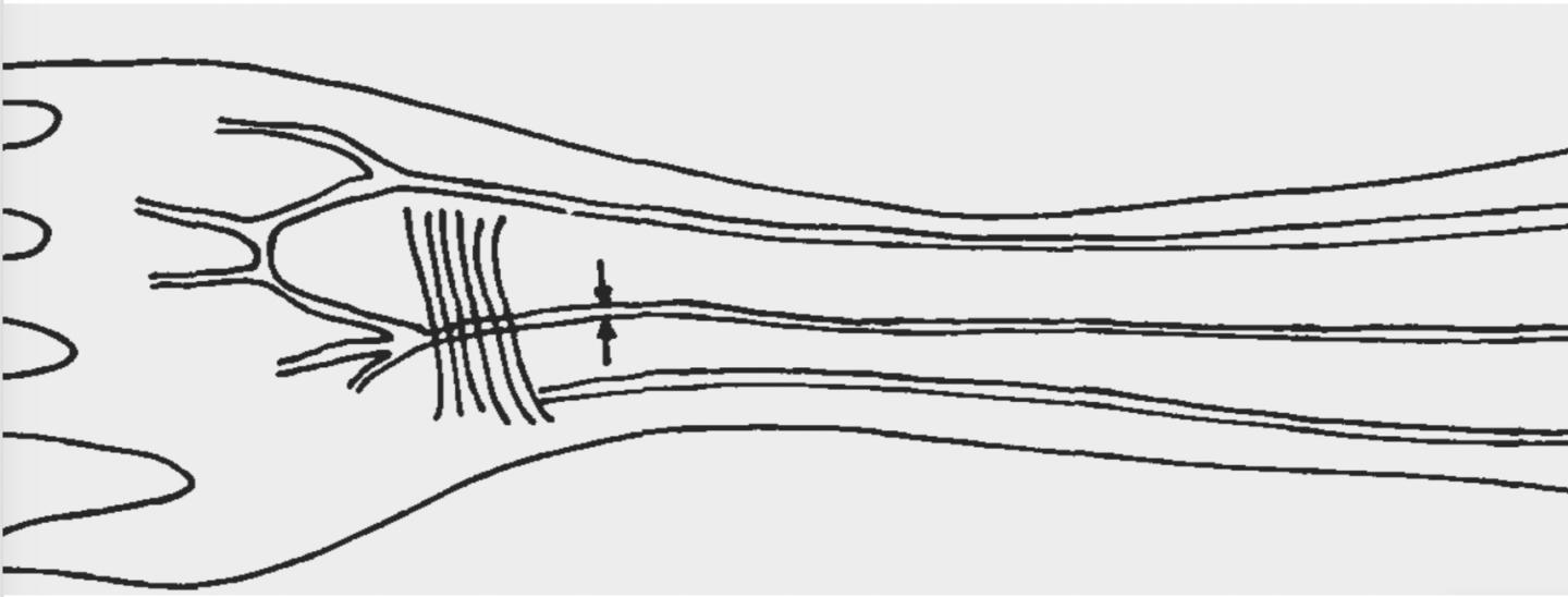 Sketch of median artery in human forearm
