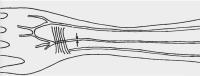 Sketch of median artery in human forearm