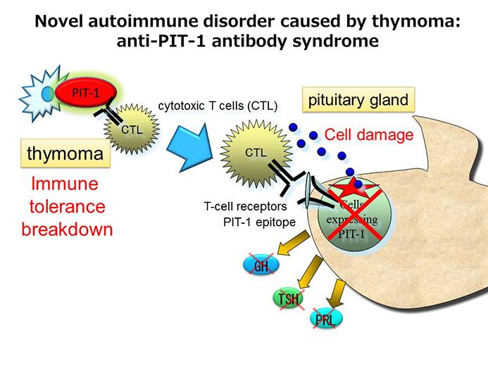 New Autoimmune Disease Triggered by Thymomas