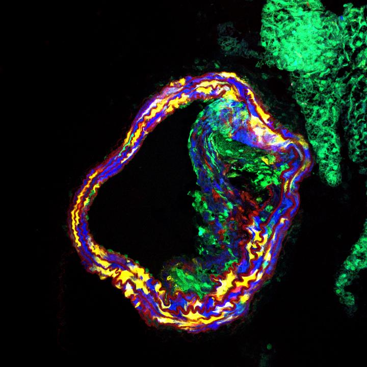 Cross-section of an atherosclerotic mouse blood vessel treated with pro-efferocytic therapy
