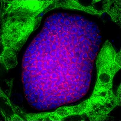 <i>P. falciparum</i> Liver Stage (1 of 2)