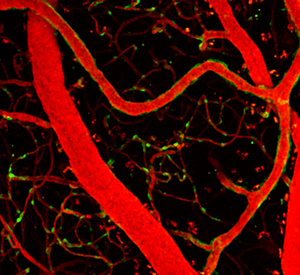 Blood vessels in the brain