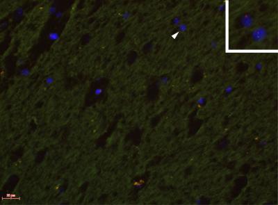 Male Cell in Female Human Brain