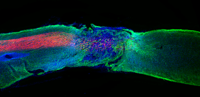 Spinal cord section