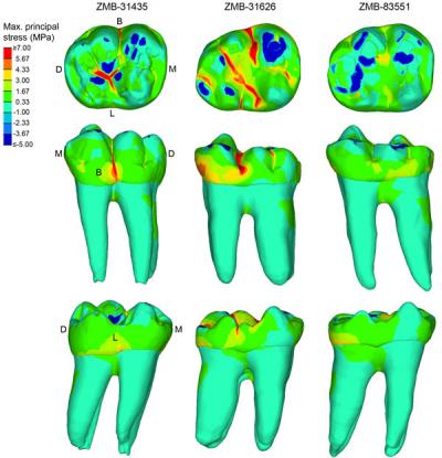 Teeth Stress Distribution