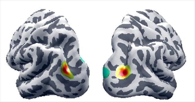EEG Brain Scan