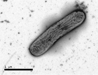 Bacteria in Sediment