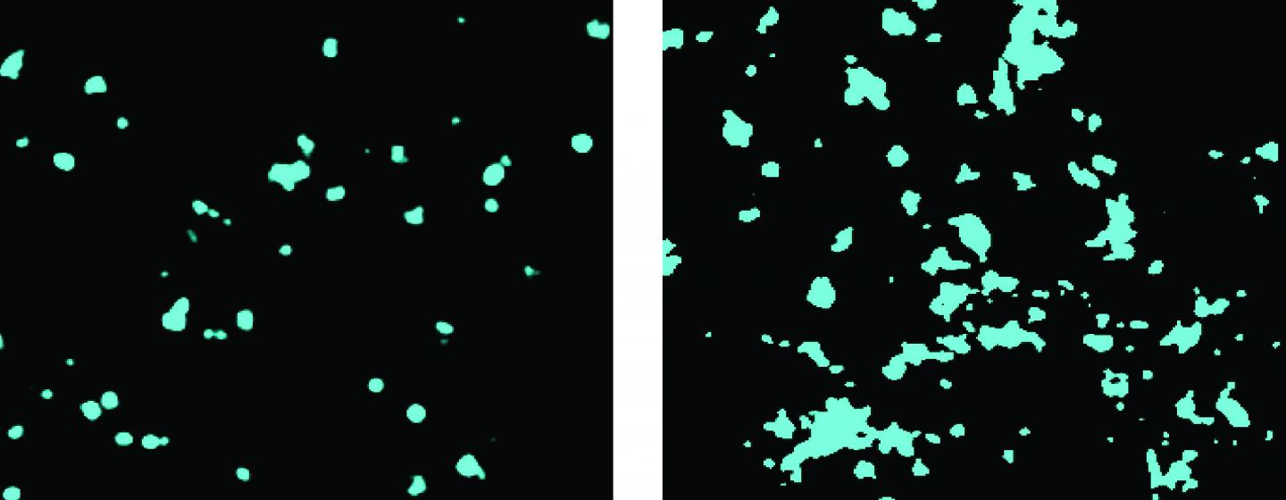 Anesthesia Disrupts Cholesterol 'Rafts' in Membrane