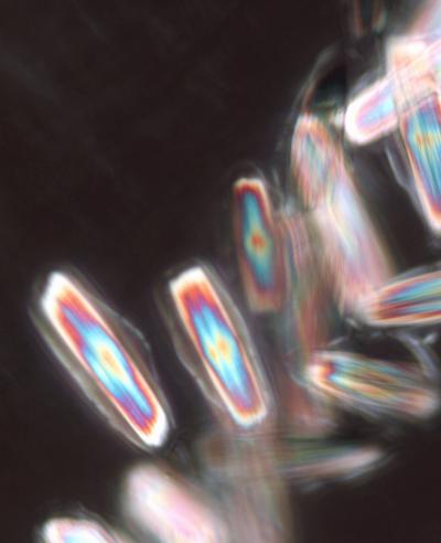 Cells Containing Bundles of Thin Pointed Crystals of Calcium Oxalate