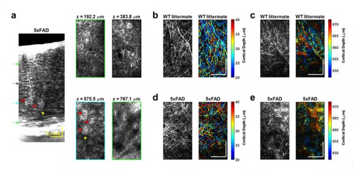 Figure 2. OCM of Alzheimer's disease mouse model.