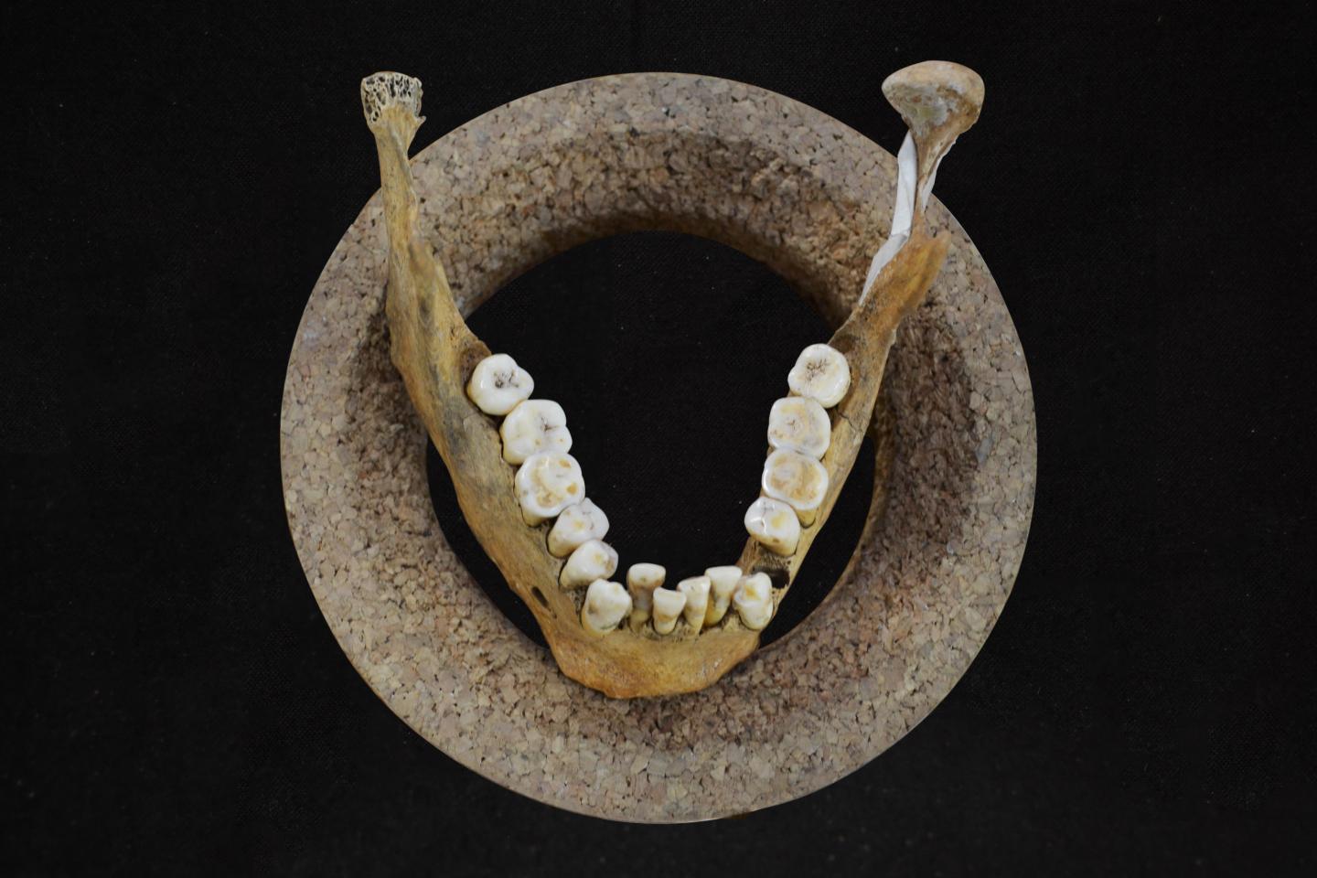 Lower Jaw and Teeth of Early Neolithic Farmer