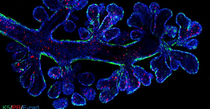 Microscopic view of breast tissue