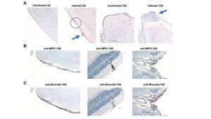 Innate lymphoid cells prevent development of meningitis following pulmonary infection