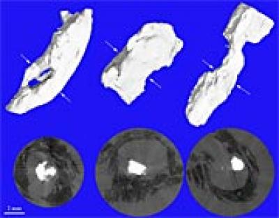 Micro-Tomography