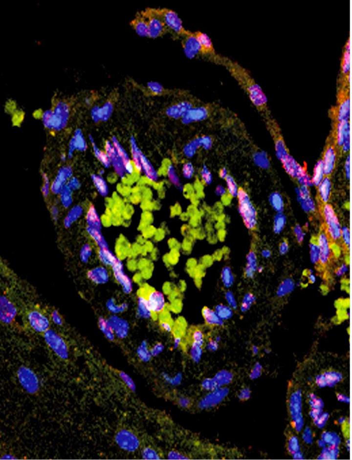 Blood Vessel in The Brain