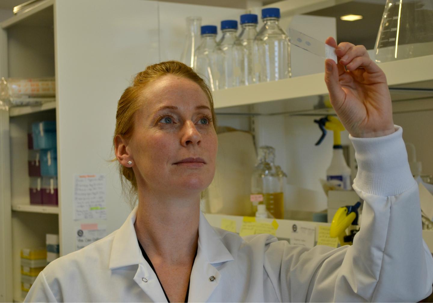 GlycoNet-Funded Research Investigates Carbohydrates To Improve Breast Cancer Screening