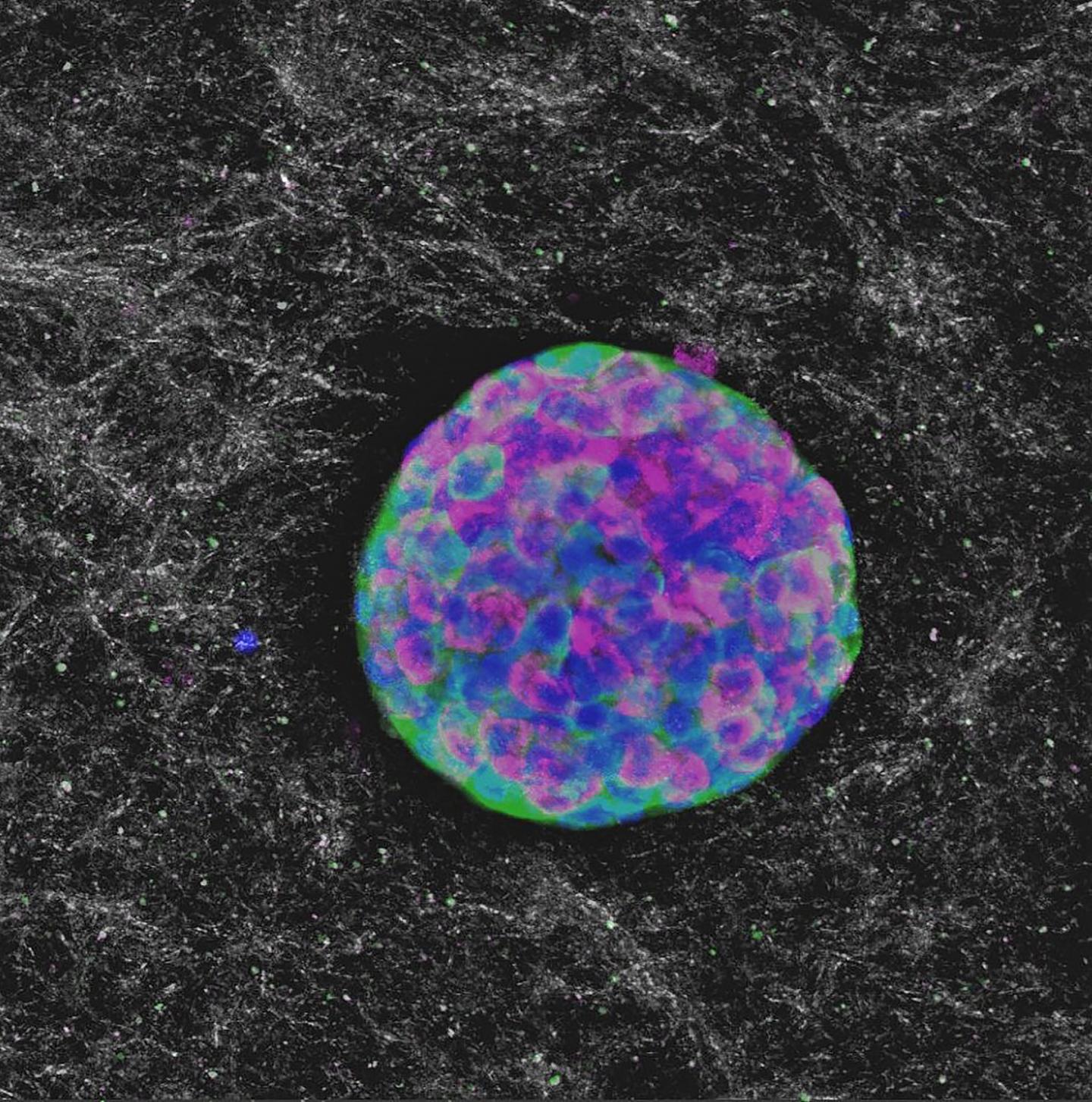 Collagen-Packaged Pancreatic Islets to Reverse Type 1 Diabetes