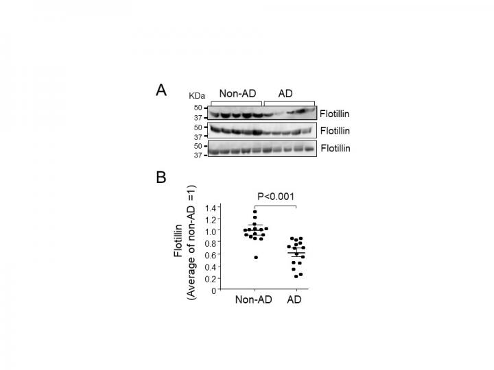 Figure 1) Serum Flotillin Levels in Patients with AD were Lower Than Those in non-AD Cases