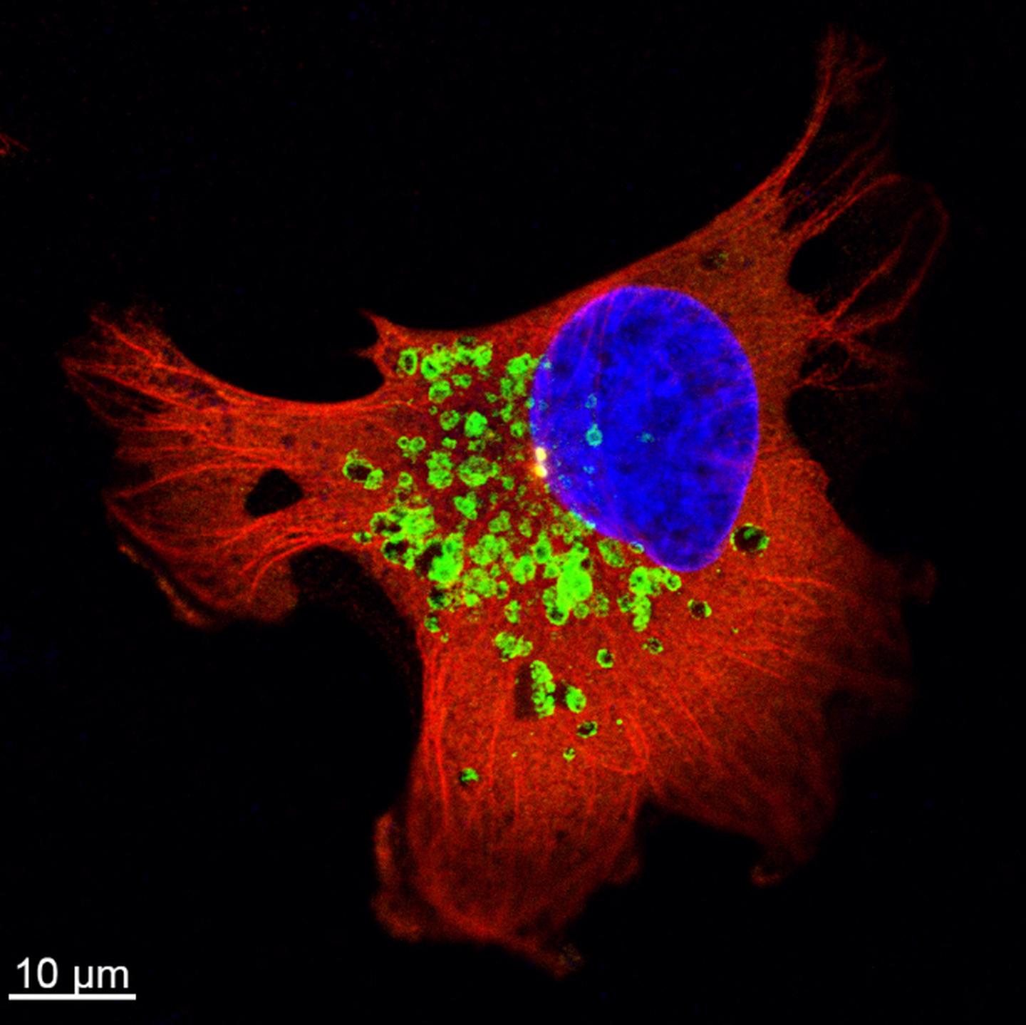 Lysosomes in a Breast Cancer Cell