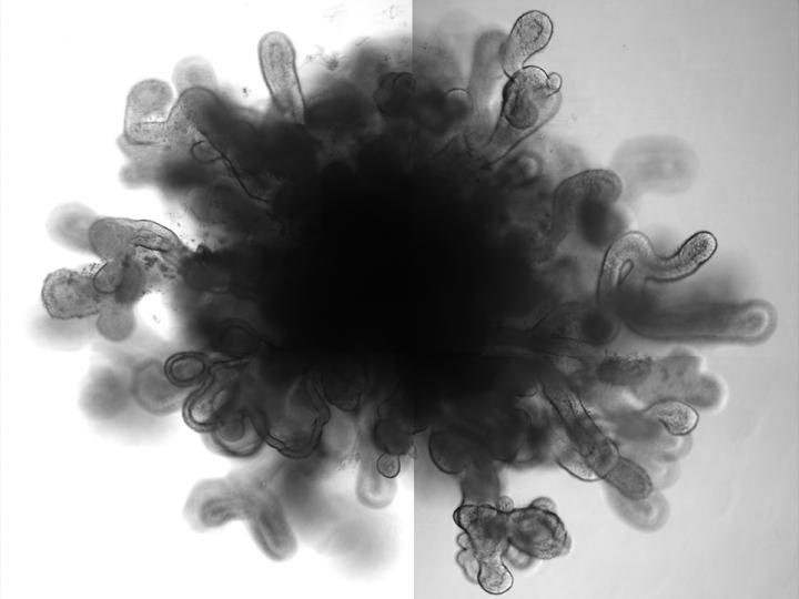 Picture of a Lung Organoid