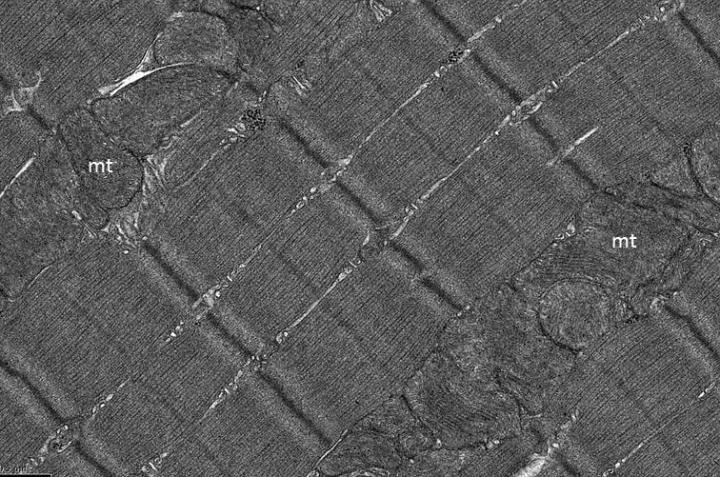 Muscle Fiber and Mitochondria