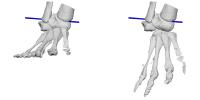Oblique ankle joint