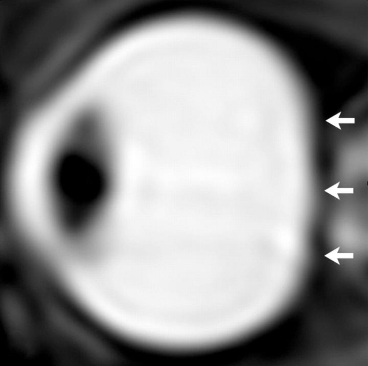 Figure 3: From 2012 Austronauts Study