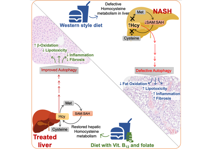 How B vitamins could potentially treat or prevent non-alcoholic steatohepatitis in people with non-alcoholic fatty liver disease