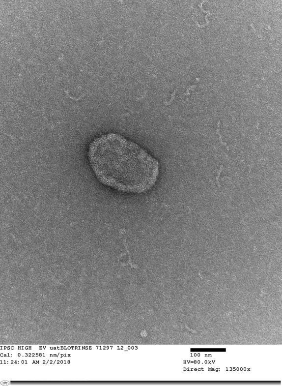 An iPSC-derived Extracellular Vesicle