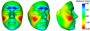 Heat Map of 3D Facial Images for Gender-Affirming Surgery