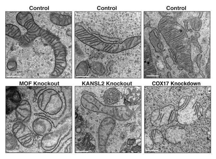 Mitochondria are beautifully packed with cristae.