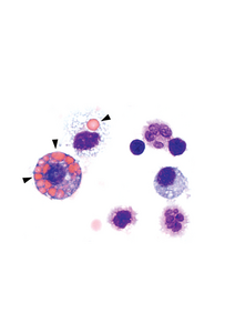 Immune cells isolated from the lungs of mice with ANCA-associated vasculitis: