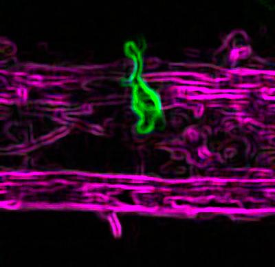 Microglia