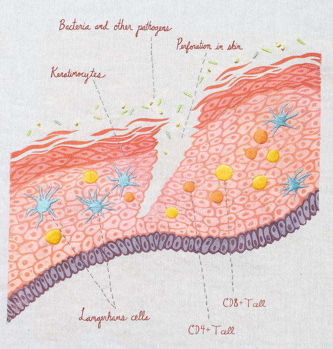 keratinocytes in skin