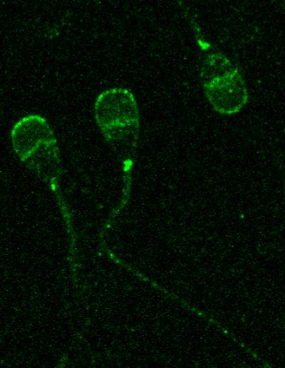 TMEM95 Protein (1 of 2)